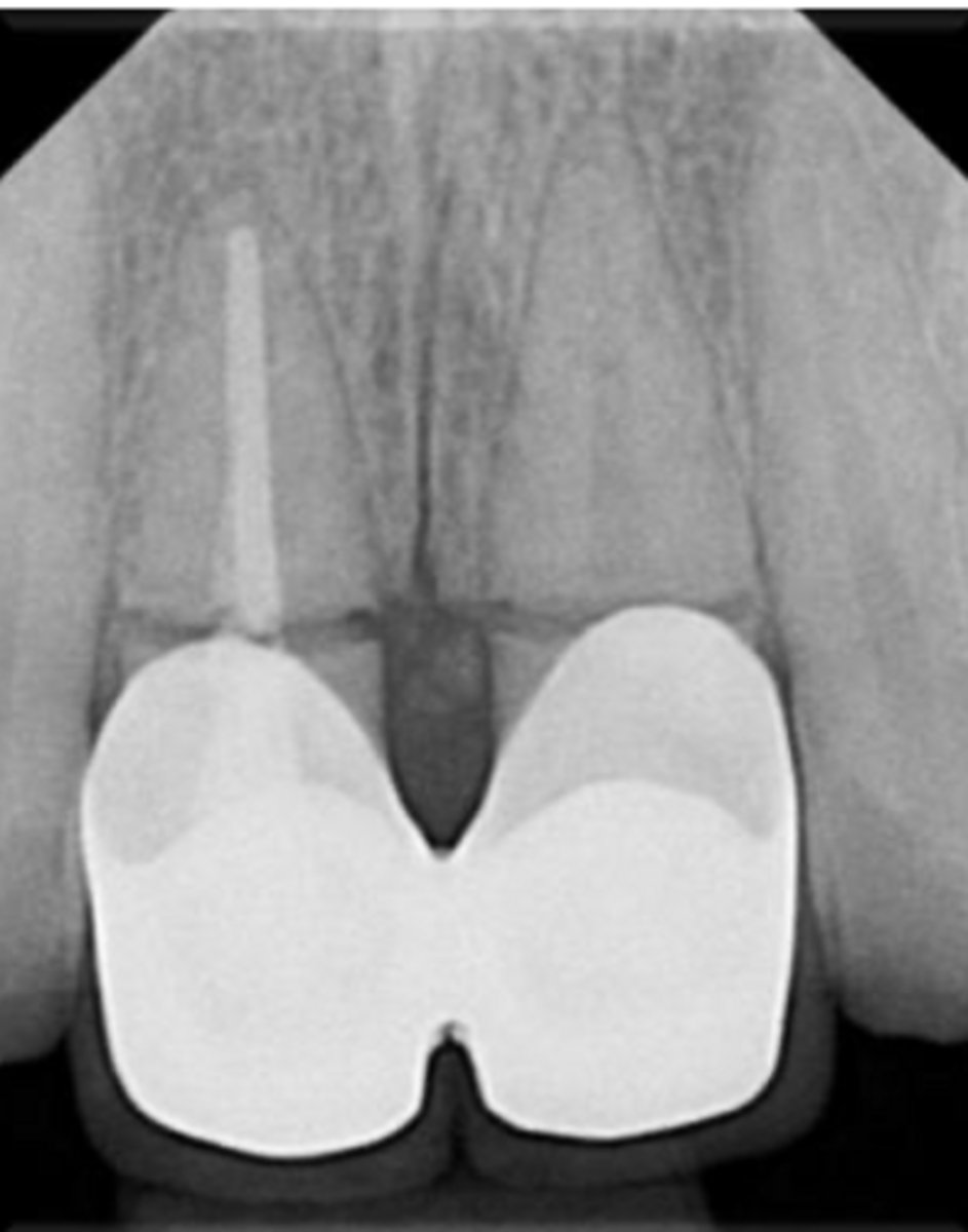 <p>ID the problem:</p>