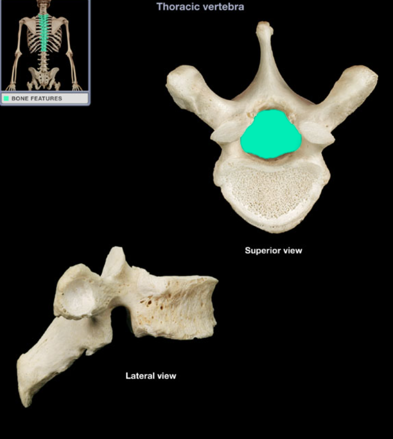 <ul><li><p>Location: Thoracic vertebra</p></li><li><p>Description: Large foramen formed by vertebral arch and posterior aspect of vertebral body</p></li></ul><p></p>