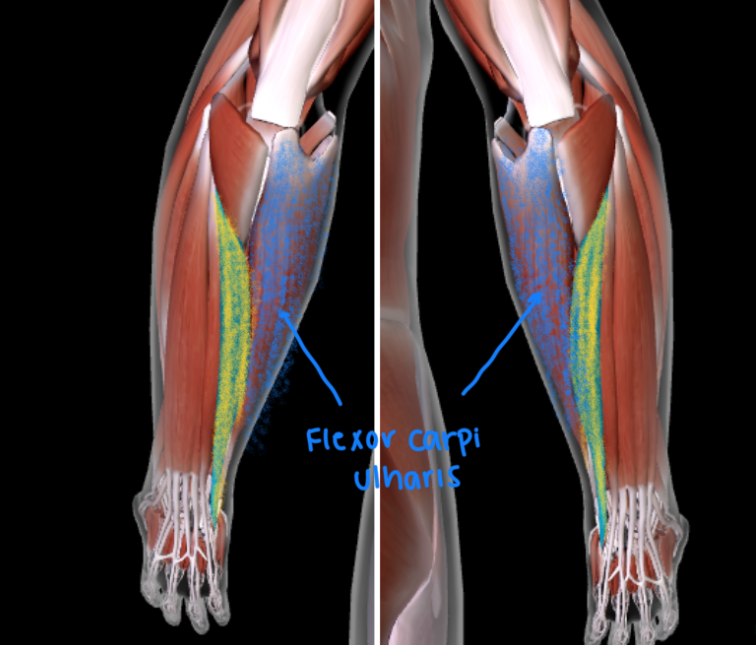 <p>Function: <strong>EXTEND AND ADDUCT WRIST</strong></p><ul><li><p><strong>POSTERIOR</strong></p></li><li><p>Next to the <strong>FLEXOR CARPI ULNARIS</strong></p></li></ul><p></p>
