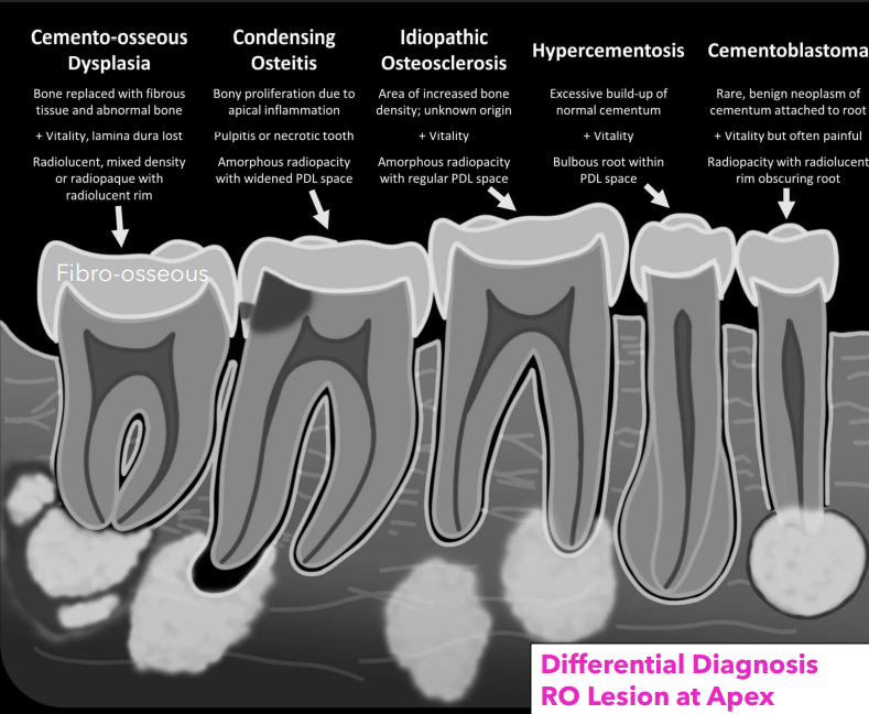 <ul><li><p>COD </p></li><li><p>condensing osteitis </p></li><li><p>idiopathic osteosclerosis </p></li><li><p>hypercementosis </p></li><li><p>cementoblastoma </p></li></ul><p></p>