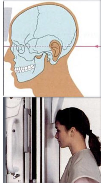 <p>Illness, trauma, or anomalies in the skull’s development. Evaluate progressive changes in the mediolateral skull dimensions (asymmetry). Evaluation of facial structures, including frontal and ethmoidal sinuses; nasal fossae, and orbits.</p>