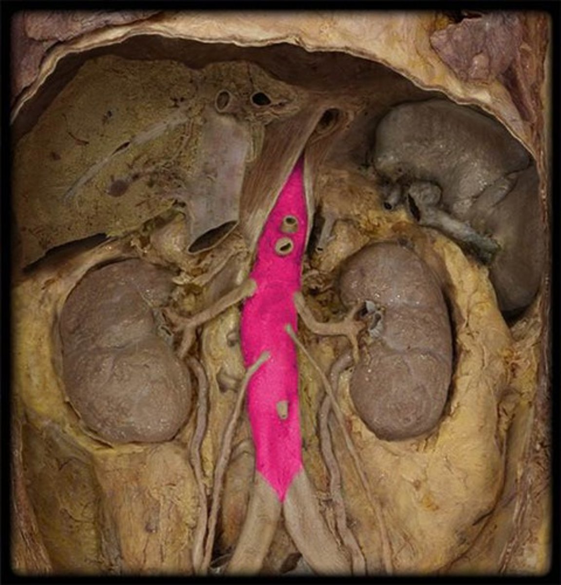 <p>Name this vessel and include what part it is.</p>