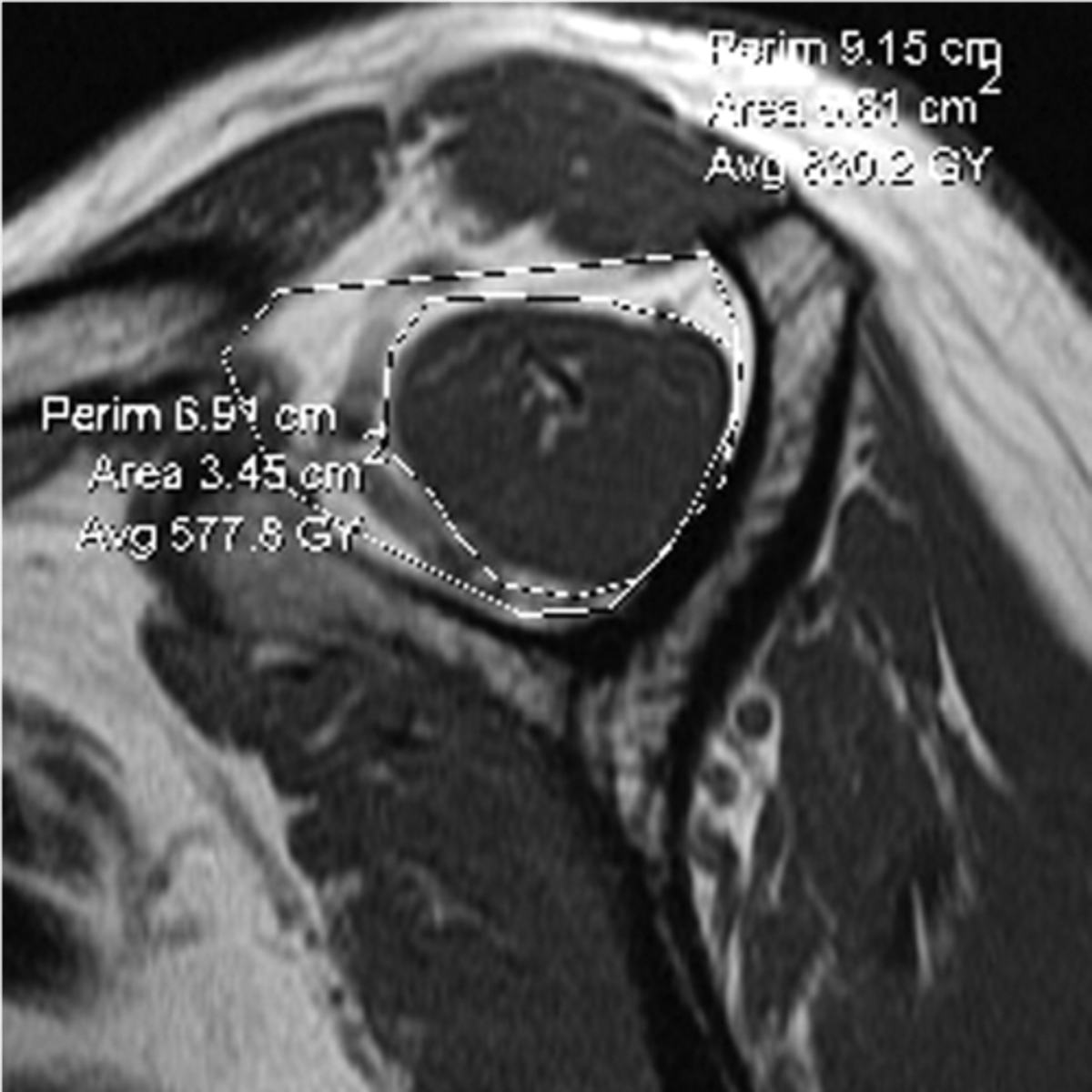 <p>What is this image depicting? Why is it important?</p>