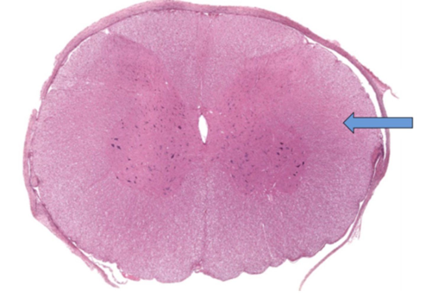 <p>Identify the part of the spinal cord</p>