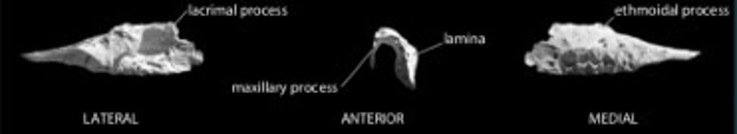 <p>inferior nasal concha</p>