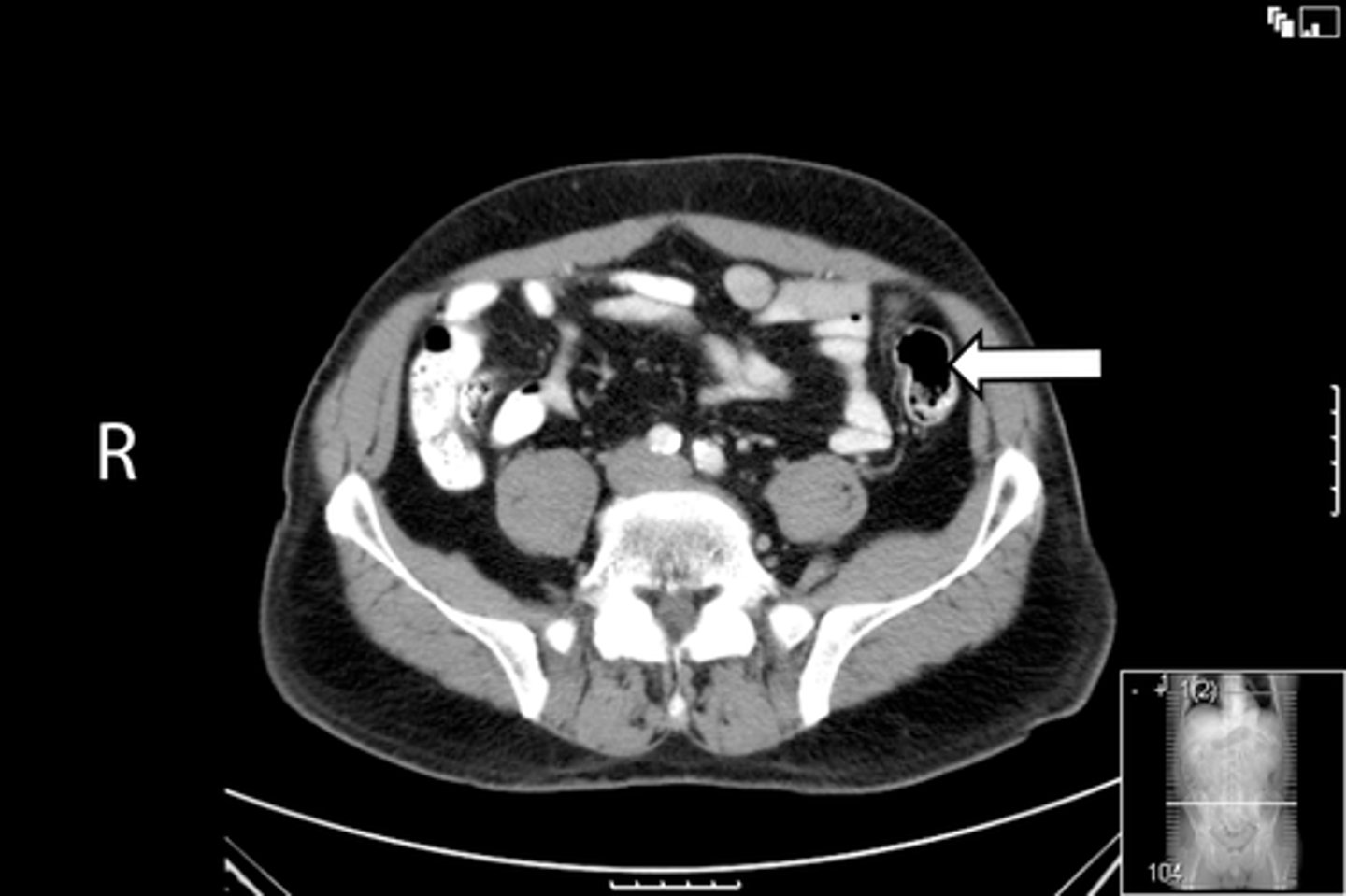 <p>What is indicated in the image?</p>
