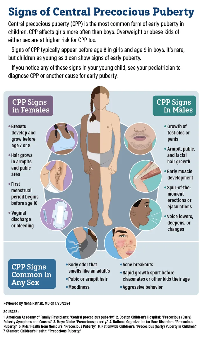 <p><span style="background-color: transparent;"><span>Defined as sexual development </span></span></p><ul><li><p><span style="background-color: transparent;"><span>before age 9 years in boys</span></span></p></li><li><p><span style="background-color: transparent;"><span>before age 7 years in Caucasian girl</span></span></p></li><li><p><span style="background-color: transparent;"><span>before 6 years in African-American girls</span></span></p></li></ul><p></p>