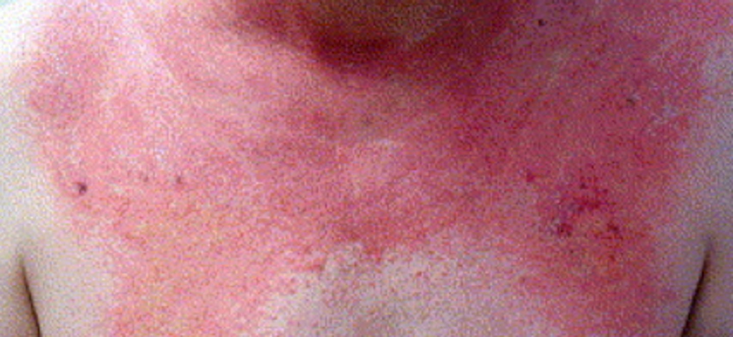 <p>What is the diagnosis?</p>