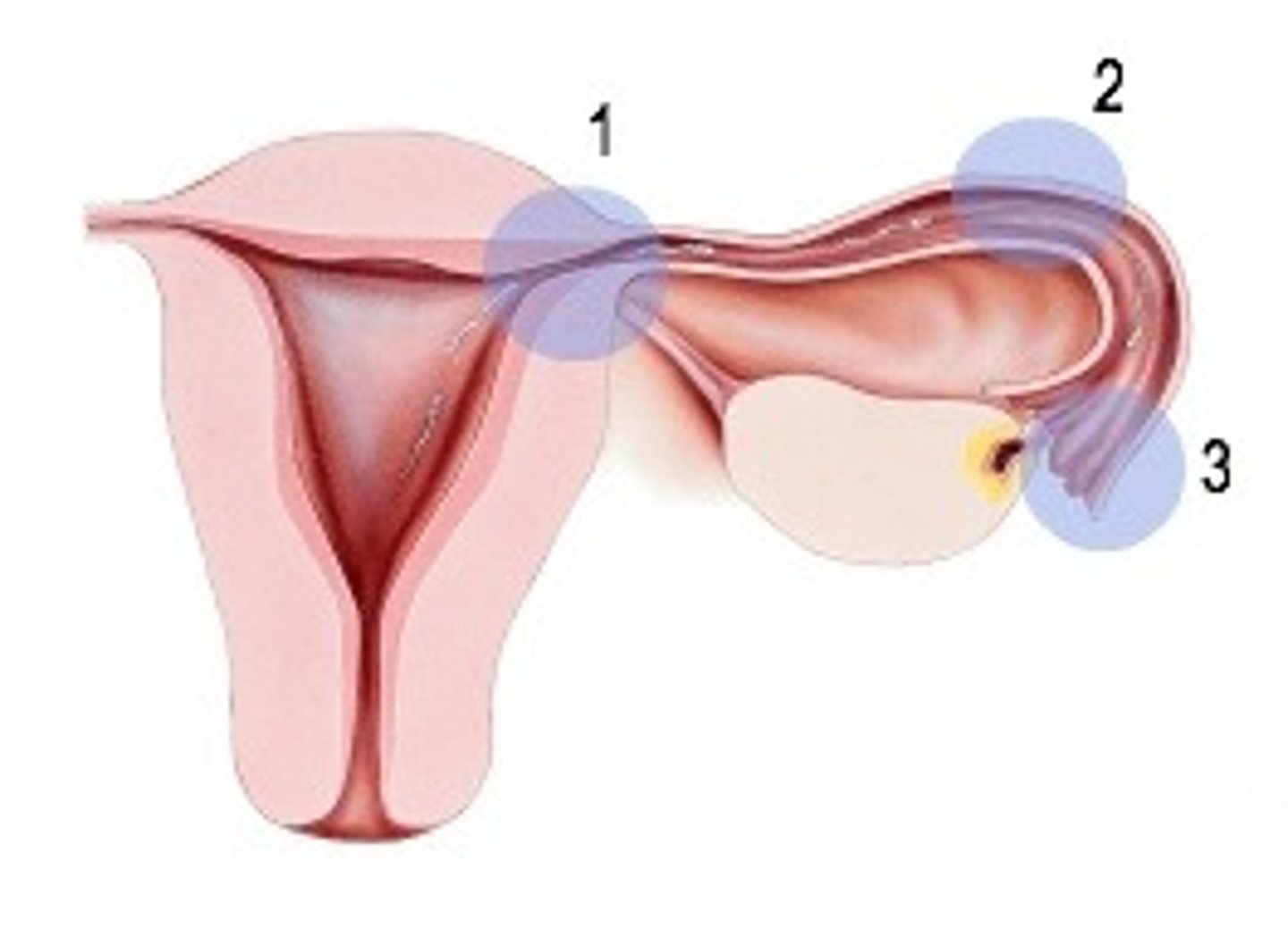 <p>The portion of the uterine tubes closest to the ovary (number 3 in picture)</p><p>Funnel shaped and have fimbriae (finger like projections)</p>