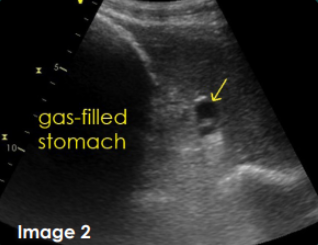 <p>Arrow - Splenic vein</p><p>Box - Gas filled stomach</p><p>Place the probe sequentially at the levels of the 10th-15th intercostal spaces in the middle one third (dorsoventrally)on the left side</p><p>Gastrosplenic window</p>