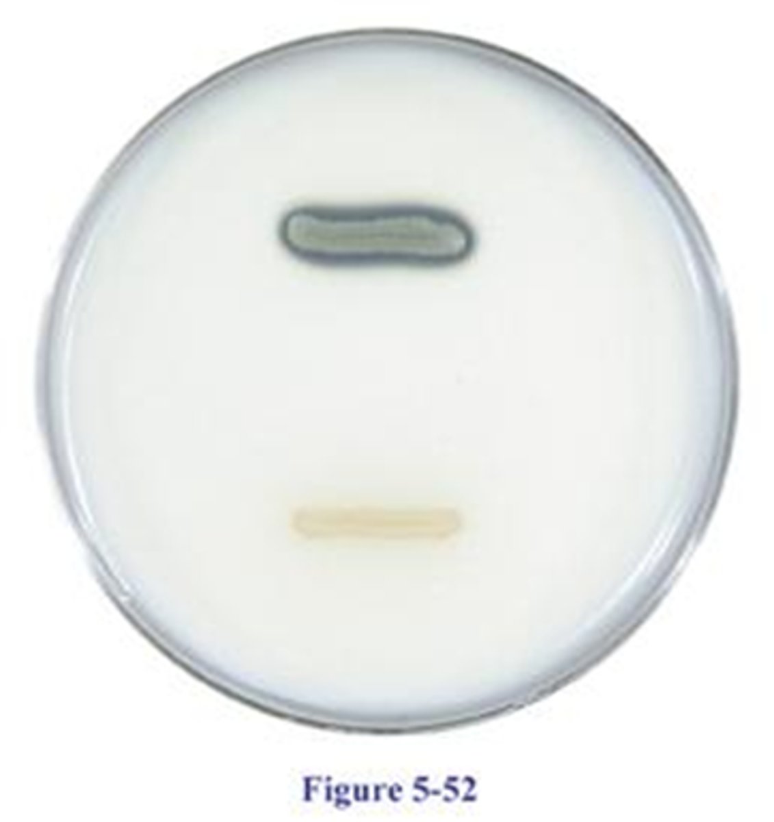<p>CASEIN HYDROLYSIS (CASEASE TEST)</p><p>Clearing in agar indicates . . .</p>