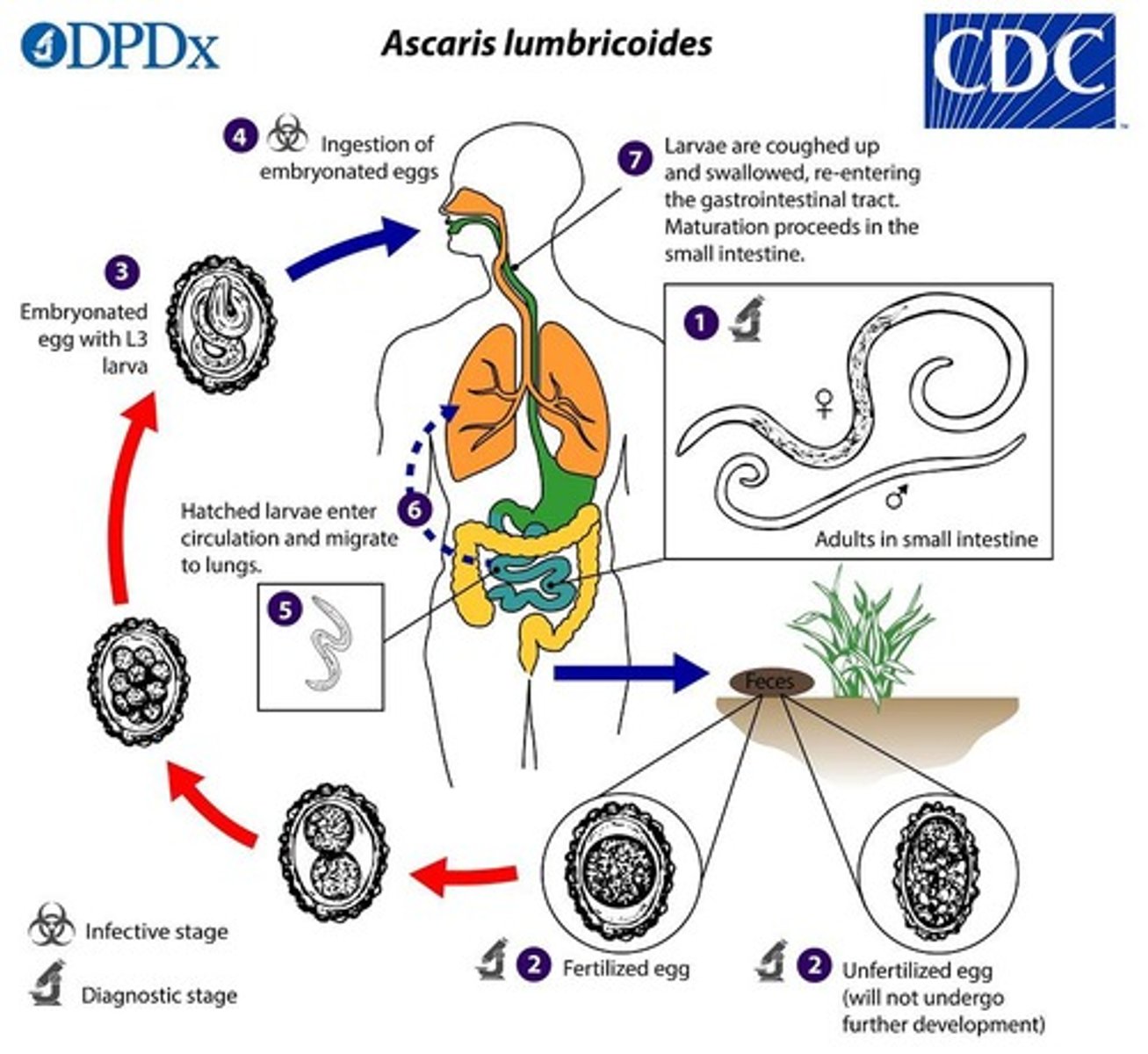 <p>Taeniasis (tapeworm infection).</p>