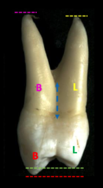 <p>lingual root is LARGER</p><p>buccal root is slightly LONGER</p>