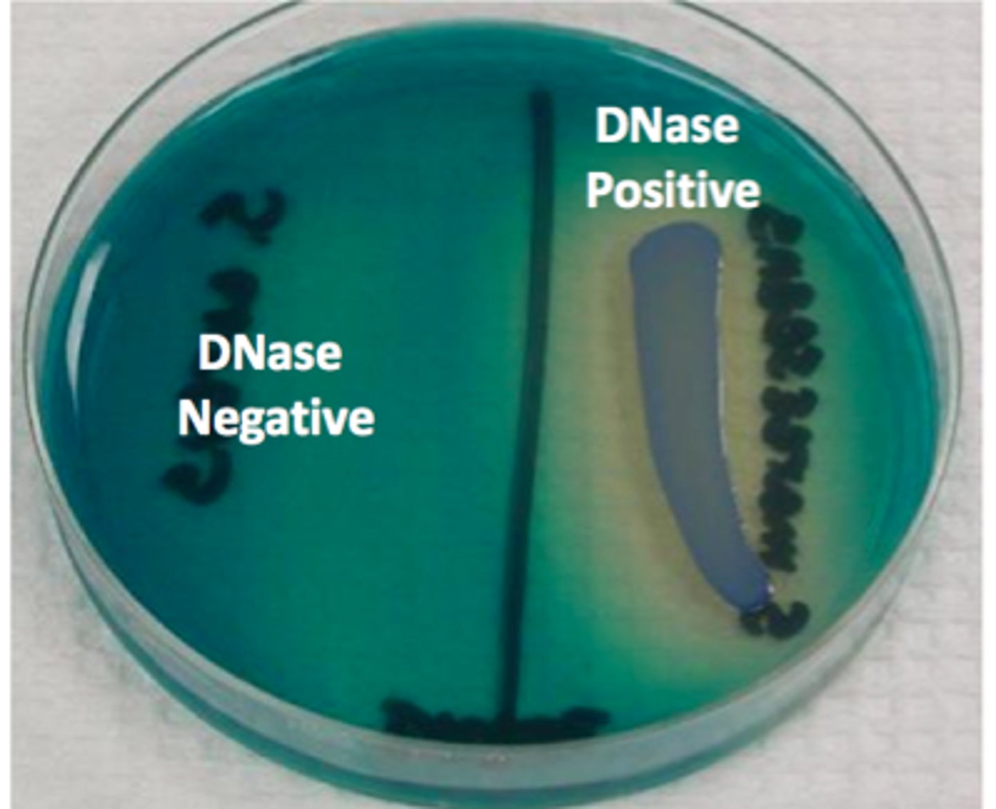 <p>Staphylococcus aureus</p>