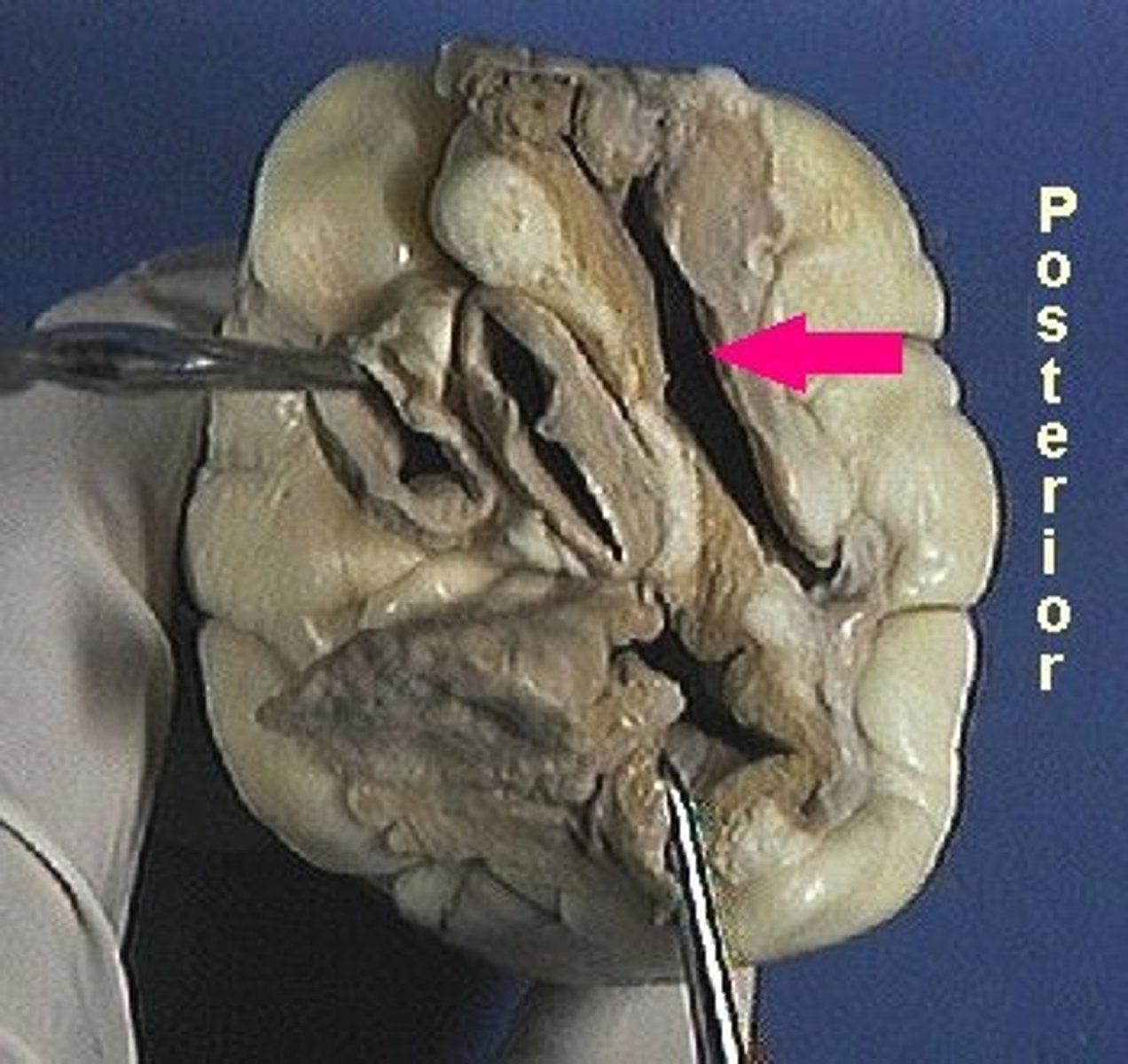 <p>Identify the chamber.</p><p>Thin-walled chamber of the heart above the right ventricle. This chamber includes the right auricle (right auricular appendage).</p>