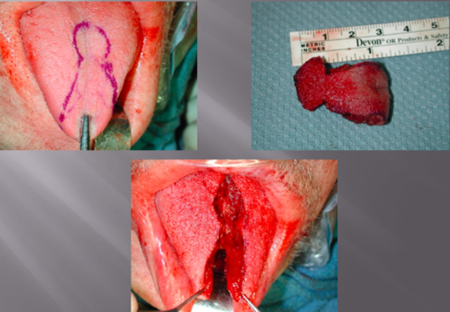 <p>ID the procedure:</p>