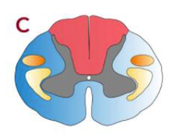 <p>Describe the effects of the lesion</p>
