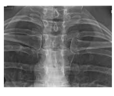 <p>Identify the structure ? View?</p>