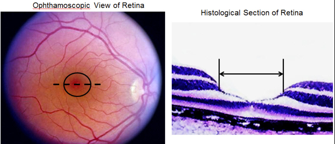 <p>View two images below. The right image is a histological section in the plane indicated by the dotted line in the left image.</p><p>Which of the listed terms is the correct term for the region circled in the left image and between the lines in the right histological</p><p>a) hyaloid canal</p><p>b) optic disc</p><p>c) fovea centralis</p><p>d) macula lutea</p><p>e) optic papilla</p>