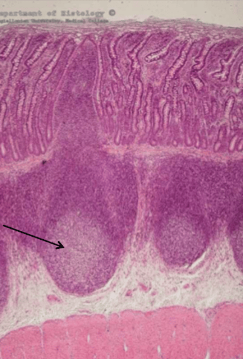 knowt flashcard image