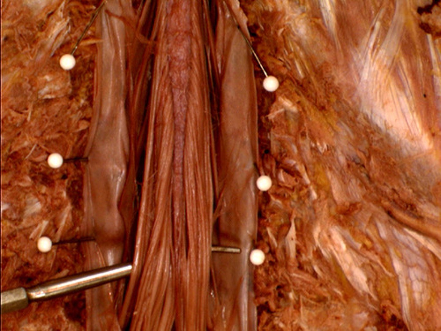 <p>"horse's tail", a fan of nerve fibers below the spinal cord</p>
