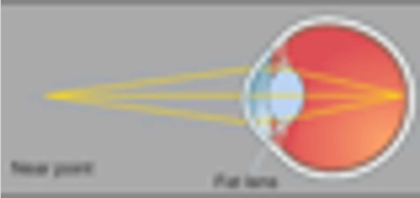 <p>How does the lens accommodate closer objects (&lt;7m away)?</p>