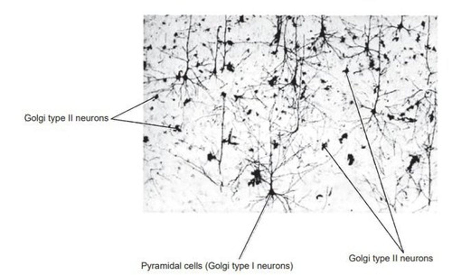 <p>Long axon, may exceed 1 meter in length.</p>