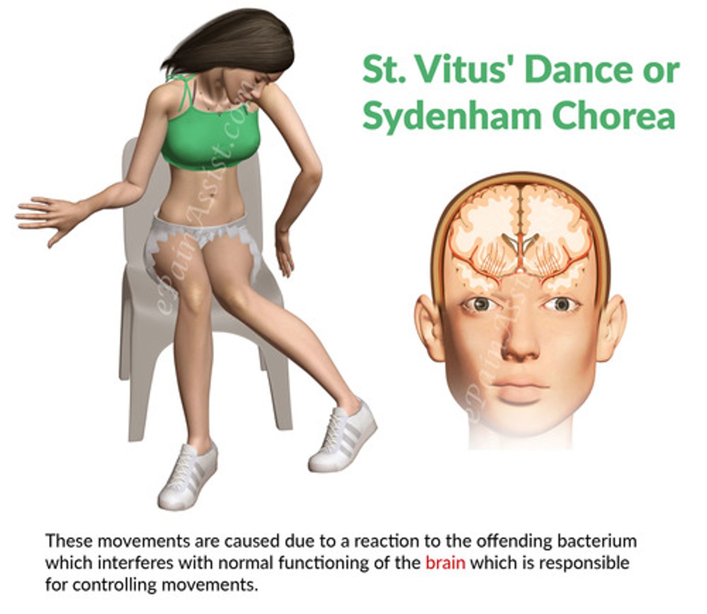 <p>jerky, uncontrollable and purposeless movements of the hands, arms, shoulder, face, legs, and trunk. These movements look like twitches, and disappear during sleep</p><p>This is known as chorea or St. Vitus’ dance.</p>