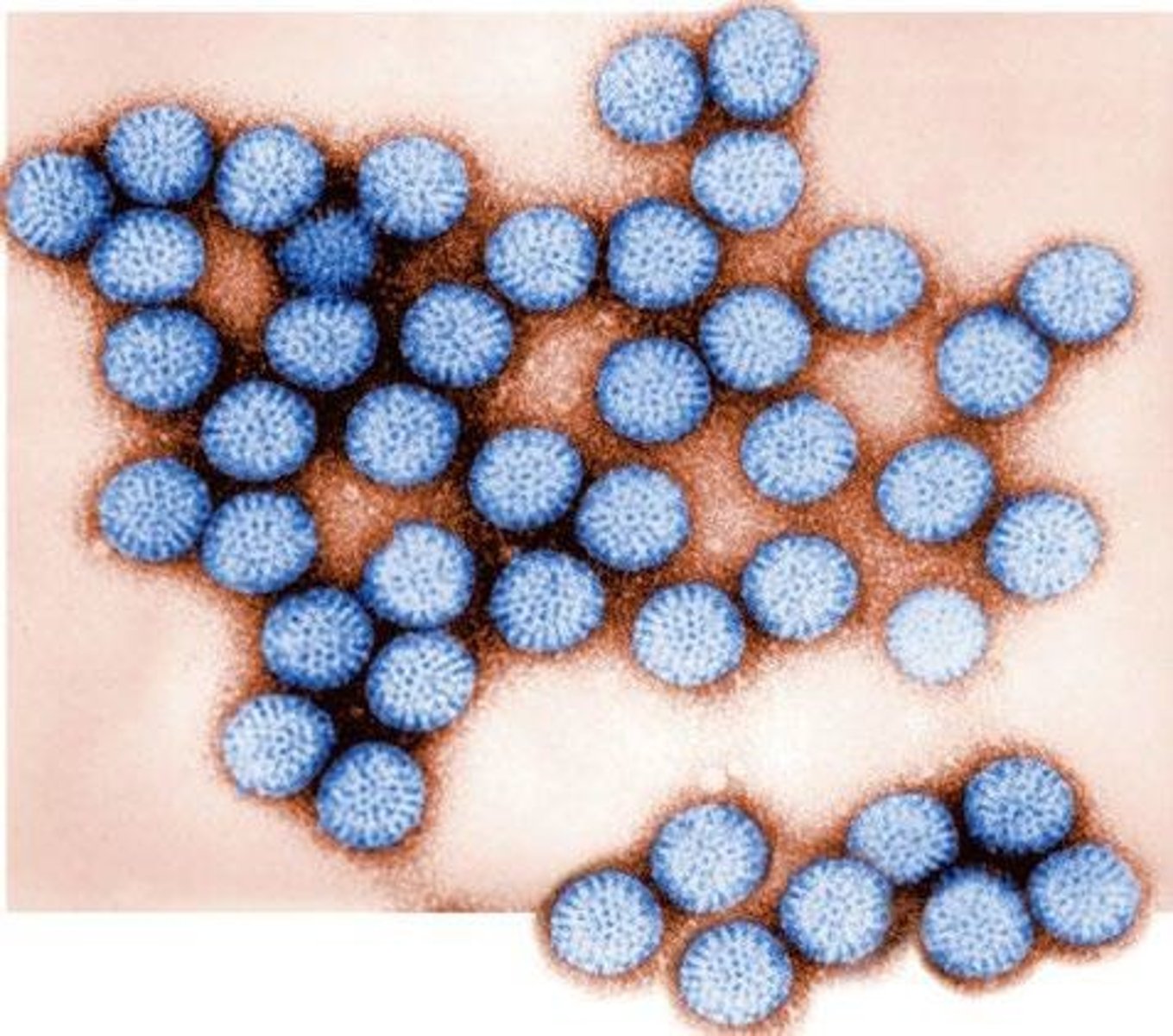 <p>Noroviruses.</p>