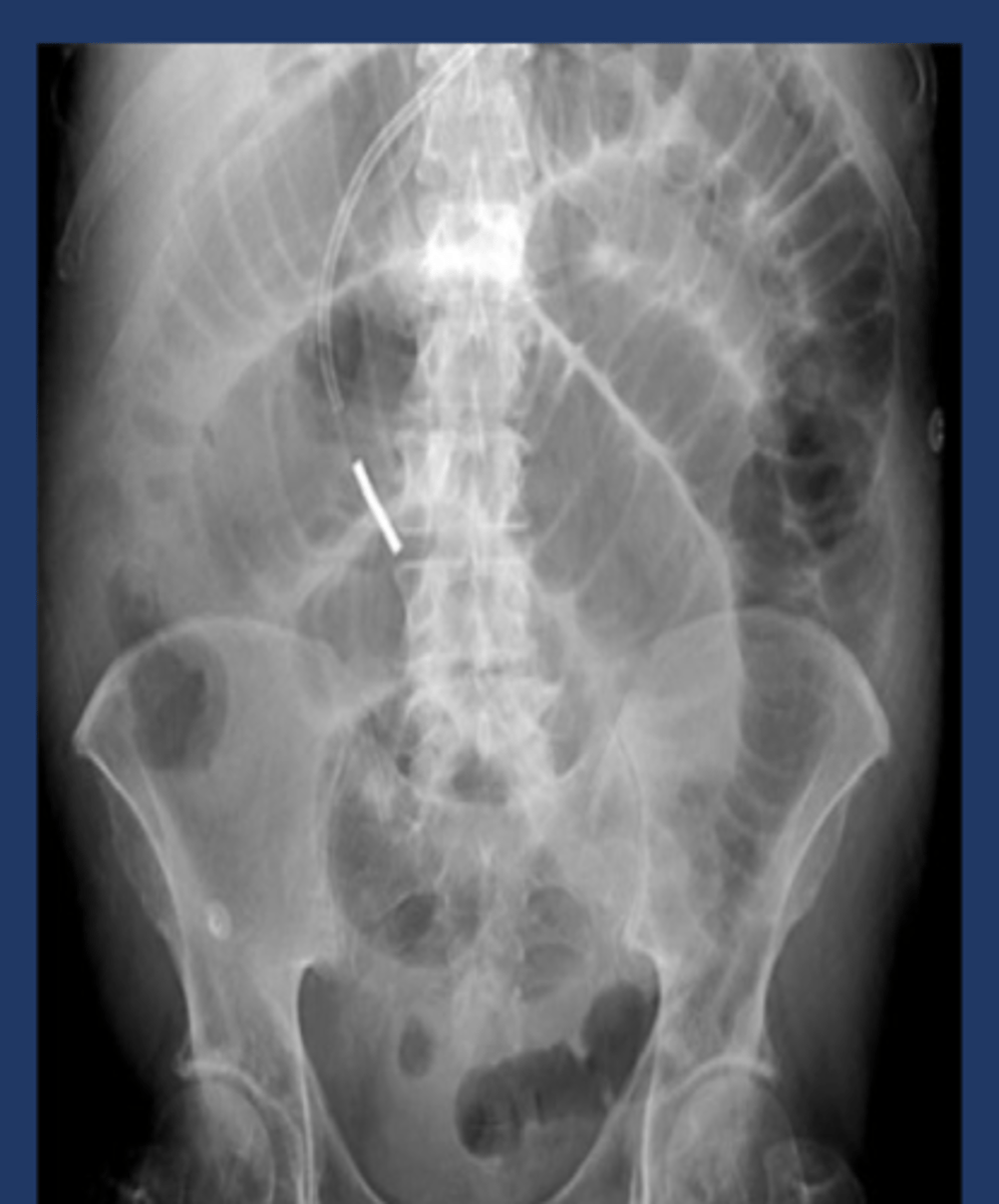 <p>identify what this is</p>
