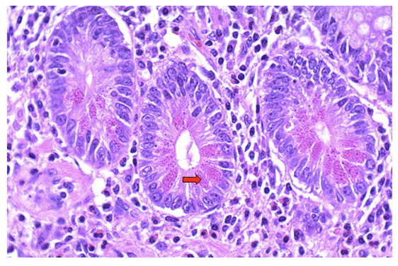 <p><span><strong>Identify cell type from small intestine:</strong></span></p>