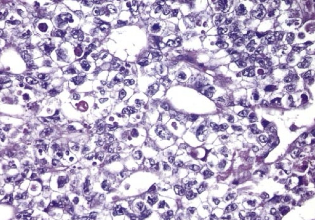 term image