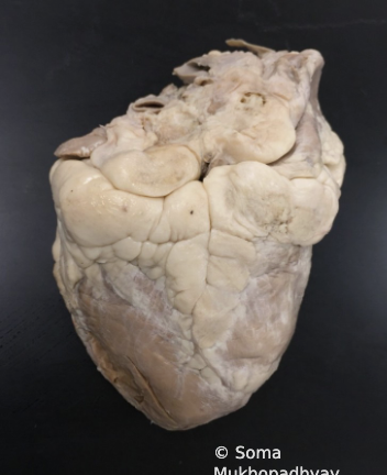 <p>Is this the anterior view or posterior view?</p>