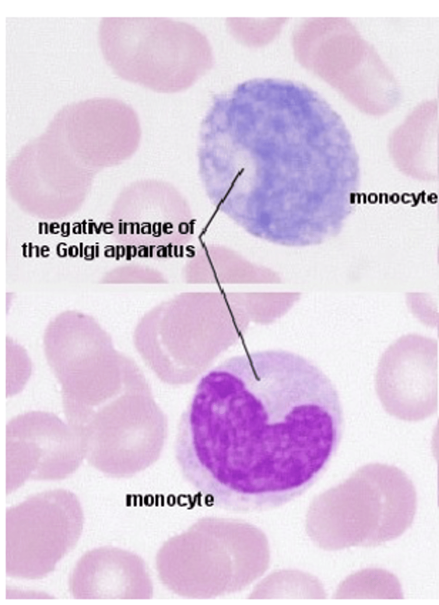 <p>How does the Golgi apparatus stain in light microscopy? </p>