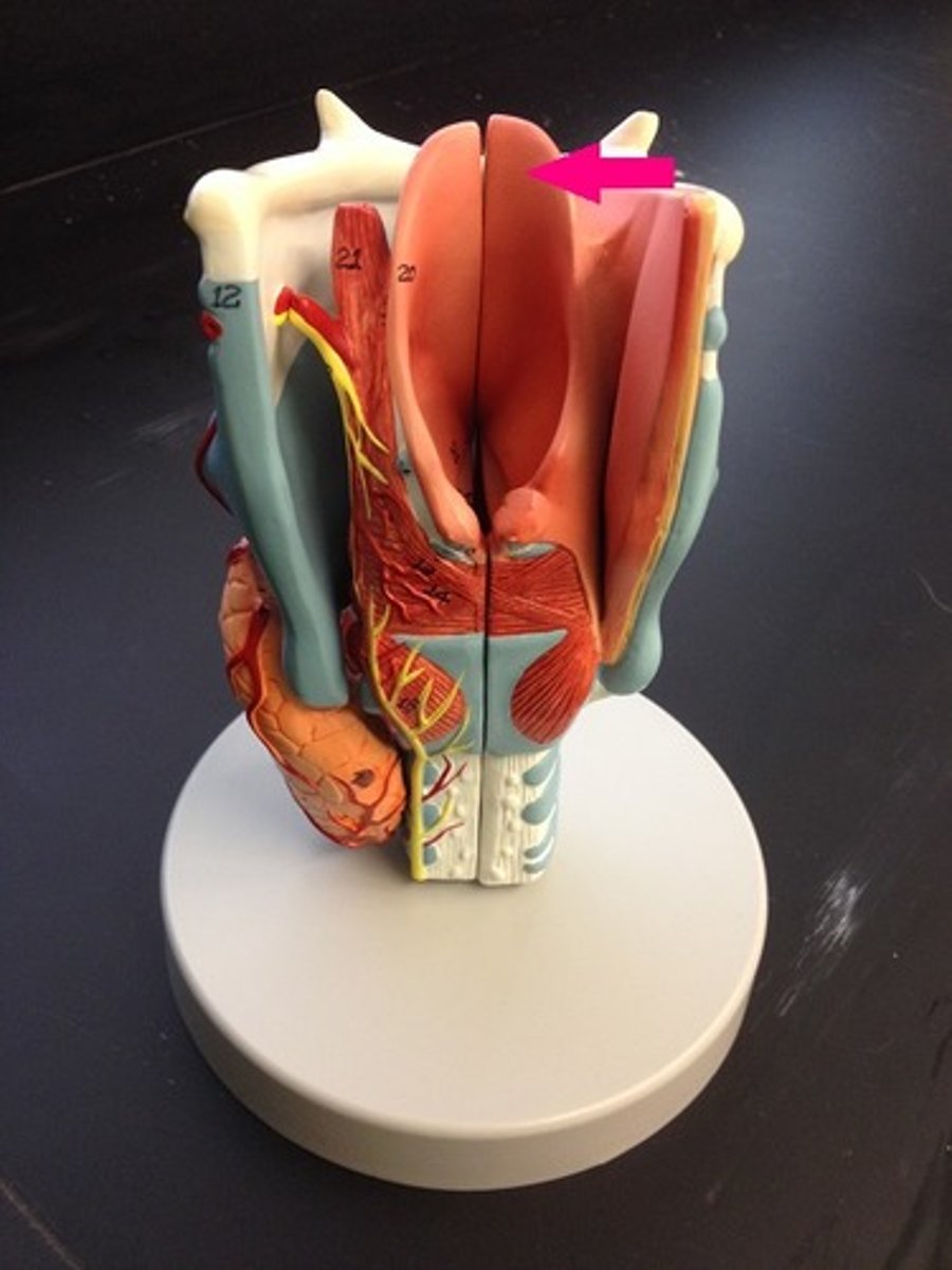 <p>Identify the flap.</p>