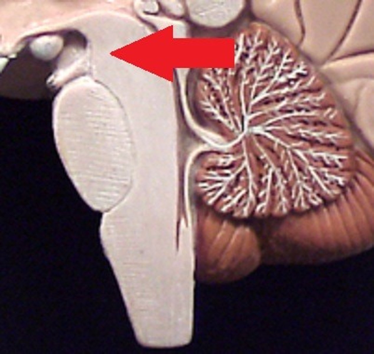 <p>midbrain carry from stem to cerebral</p>
