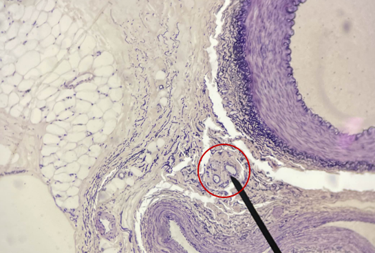 <p>What is the pointer on?&nbsp;</p>