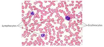 <ul><li><p>DESCRIPTION: fluid connective tissue containing erythrocytes and various types of leukocytes that circulate in a liquid extracellular matrix</p></li><li><p>LOCATION: flows within the cardiovascular system</p></li><li><p>FUNCTION: hemocytoblasts (specialized cell) gives rise to three formed elements suspended in plasma:</p><ul><li><p>erythrocytes; red blood cells - transport oxygen and carbon dioxide</p></li><li><p>leukocytes; white blood cells - help defend the body from infection and disease</p></li><li><p>thrombocytes; platelets - cell fragments that are involved in the clotting response that seals broken blood vessels</p></li></ul></li></ul><p></p>