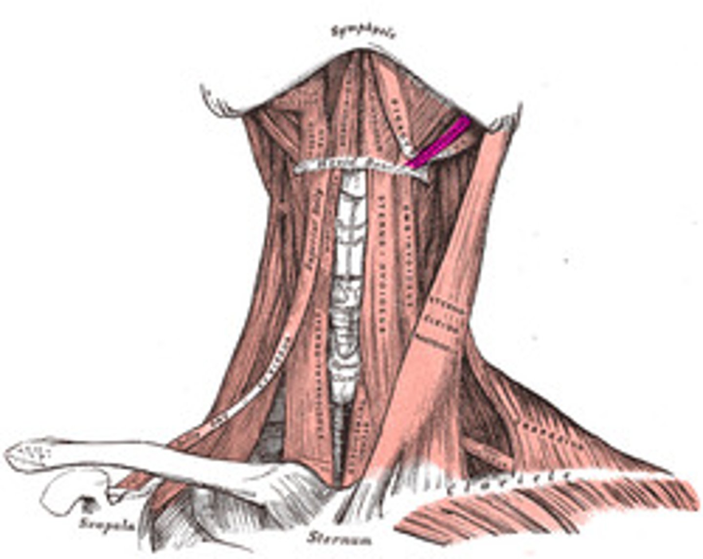 <p>thin; looks like a fiber</p>