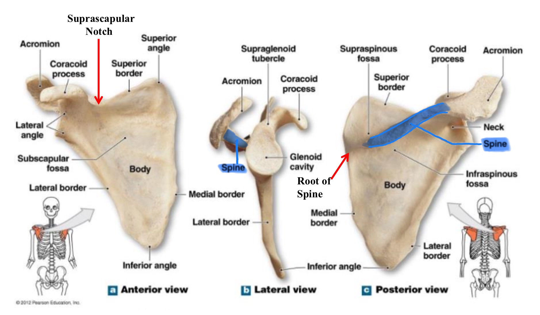 <p>spine of scapula </p>