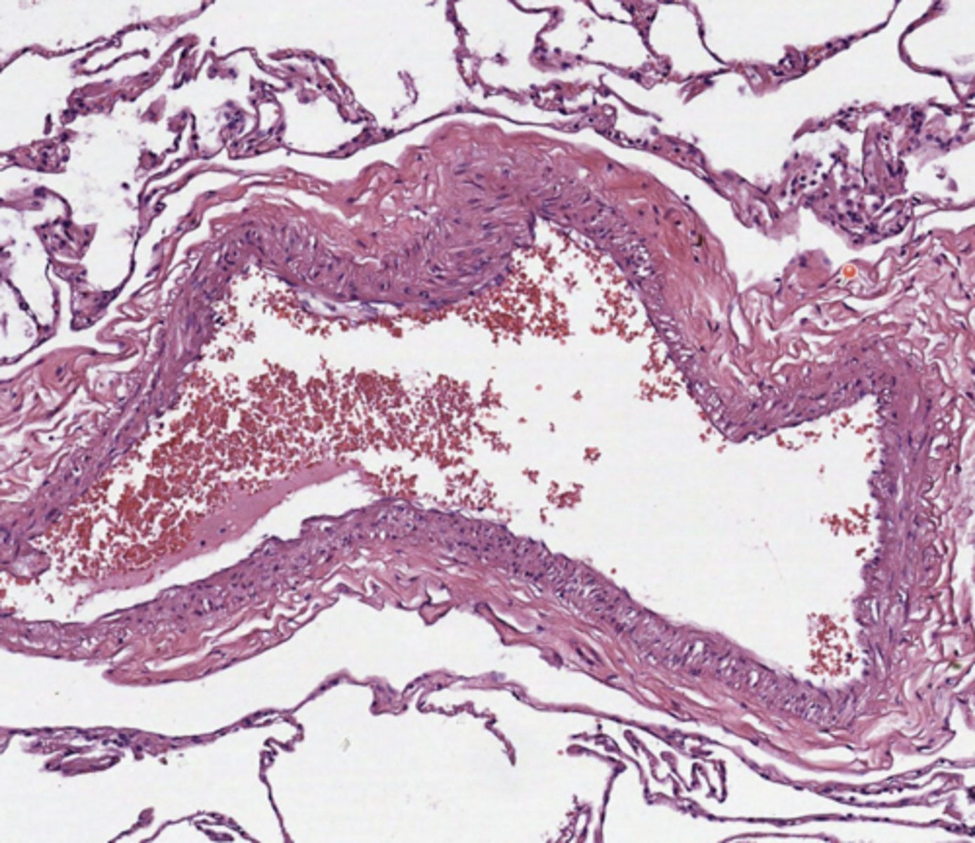 <p>Lung</p>
