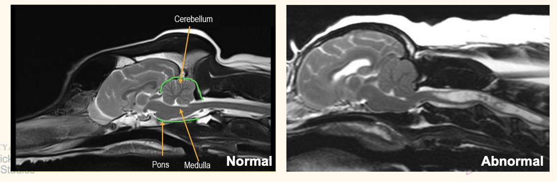 <p>CLM = congenital malformation of small-breed dogs similar to Chiari type I malformation in humans o Causes a mismatch between the volume available in the caudal fossa and the brain parenchyma located in this space, resulting in herniation of the cerebellum into the foramen magnum <span data-name="black_small_square" data-type="emoji">▪</span> Caudal fossa contains cerebellum, pons and medulla</p><p>CLM is associated with <u>progressive formation of syringomyelia (SM</u>), however, SM pathophysiology is still not clear </p><ul><li><p>Syringomyelia = fluid filled cavity within the spinal cord </p></li><li><p>One hypothesis is that CLM leads to increased pressure difference between cranial and spinal compartments o CLM and SM are often associated but they can occur independently of the other</p></li></ul><p></p>