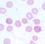 <p>Dr. Vicente Y. Belizario Jr.</p>