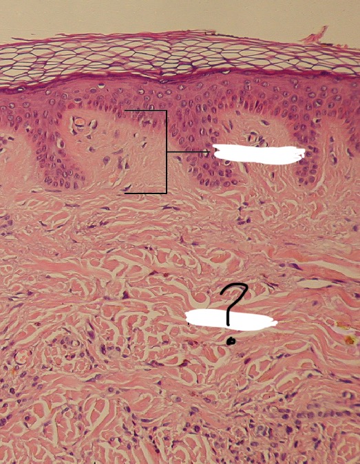 term image