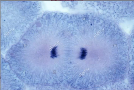 <p>Identify the Stage of Mitosis</p>