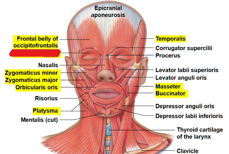 <p>What muscle is this?</p>