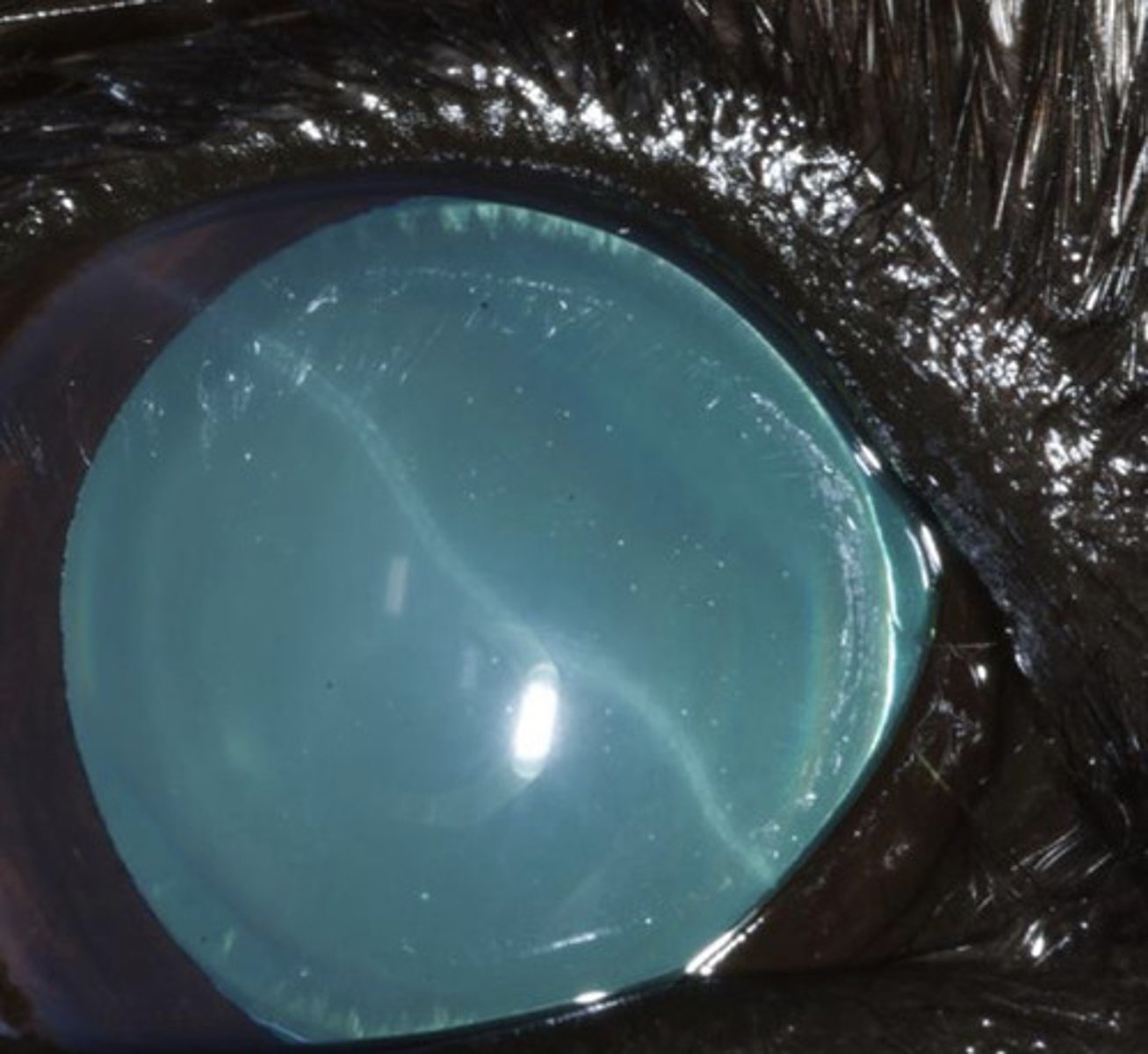 <p>What am I describing?</p><p>- White opacities</p><p>- Cracks in descemet's membrane leaving scars</p><p>- Associated with glaucoma</p>