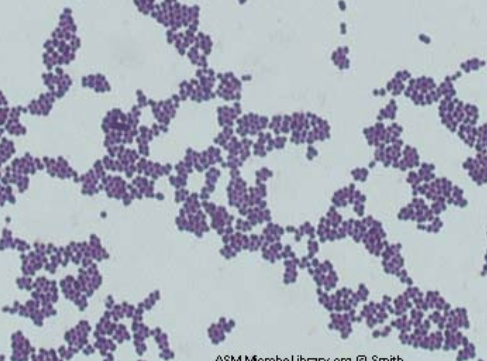 <ul><li><p>Causes both sepsis and endocarditis </p></li><li><p>Gram-positive cocci </p></li></ul><p>Diagnosis of S. aureus </p><ul><li><p>Culture is beta-hemolytic on blood agar</p></li><li><p>Catalase positive </p></li><li><p>Coagulase positive </p></li></ul><p></p>