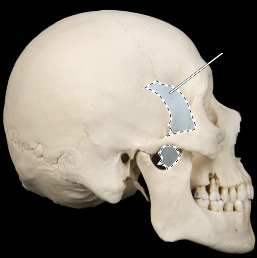 <p>Name this bone.</p><p>(Skull, lateral view).</p>