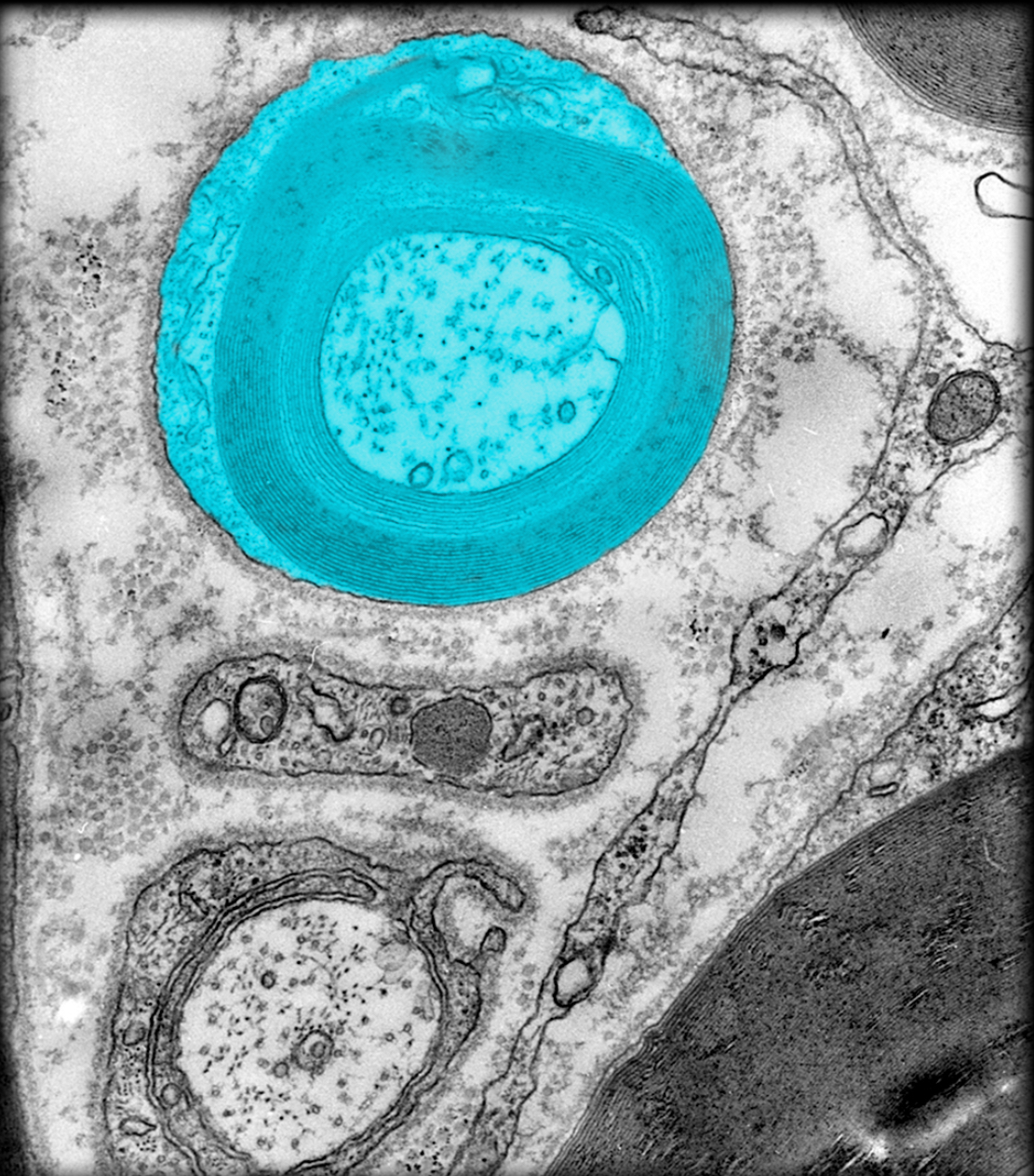 <h4 collapsed="false" seolevelmigrated="true"><strong>Location:</strong></h4><ul><li><p>Peripheral nervous system</p></li></ul><h4 collapsed="false" seolevelmigrated="true"><strong>Description:</strong></h4><ul><li><p>Neuroglial cell</p></li></ul><h4 collapsed="false" seolevelmigrated="true"><strong>Function:</strong></h4><ul><li><p>Forms myelin sheath around a single axon</p></li><li><p>Myelin sheath increases speed of nerve impulse conduction</p></li><li><p>Structural and metabolic support for axons</p></li></ul><h4 collapsed="false" seolevelmigrated="true"><strong>Also known as:</strong></h4><ul><li><p>Neurolemmocyte</p></li></ul><h4 collapsed="false" seolevelmigrated="true"><strong>Comment:</strong></h4><ul><li><p>Myelin sheath is cell membrane wrapped spirally (up to 100 times) around axon</p></li><li><p>Oligodendrocyte in CNS can form myelin sheath around more than one axon</p></li></ul>